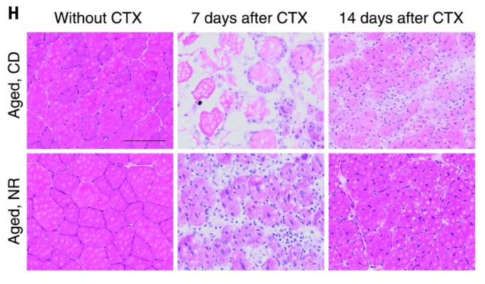 NAD And The Hallmarks Of Aging Series Part 8 Stem Cell Exhaustion